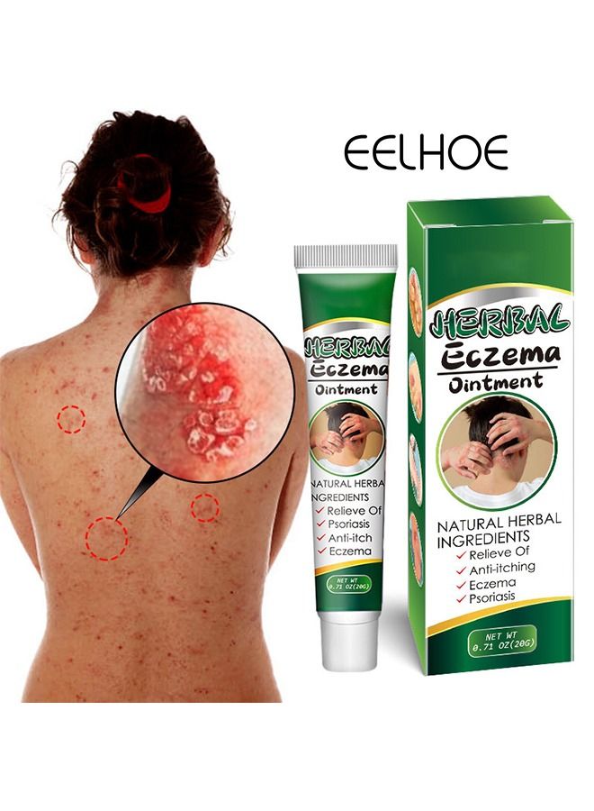 EELHOE Treatment Psoriasis Eczema Cream Antibacterial Antipruritic Dermatitis Herbal Ointment Anti-itch Medical Plaster - Image 1