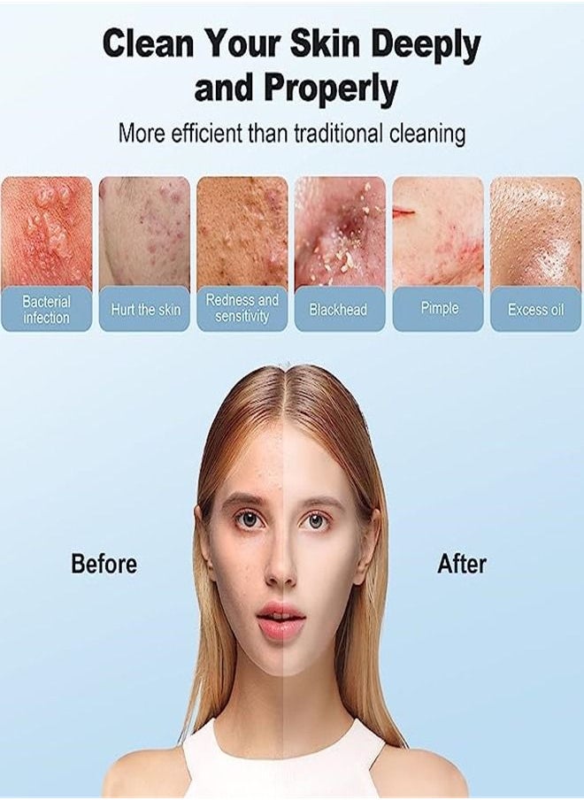 Generic - Blackhead remover, can be connected to the phone to use a magnifying glass, for exfoliating deep cleansing beauty instrument, with acne tool kit - Image 1