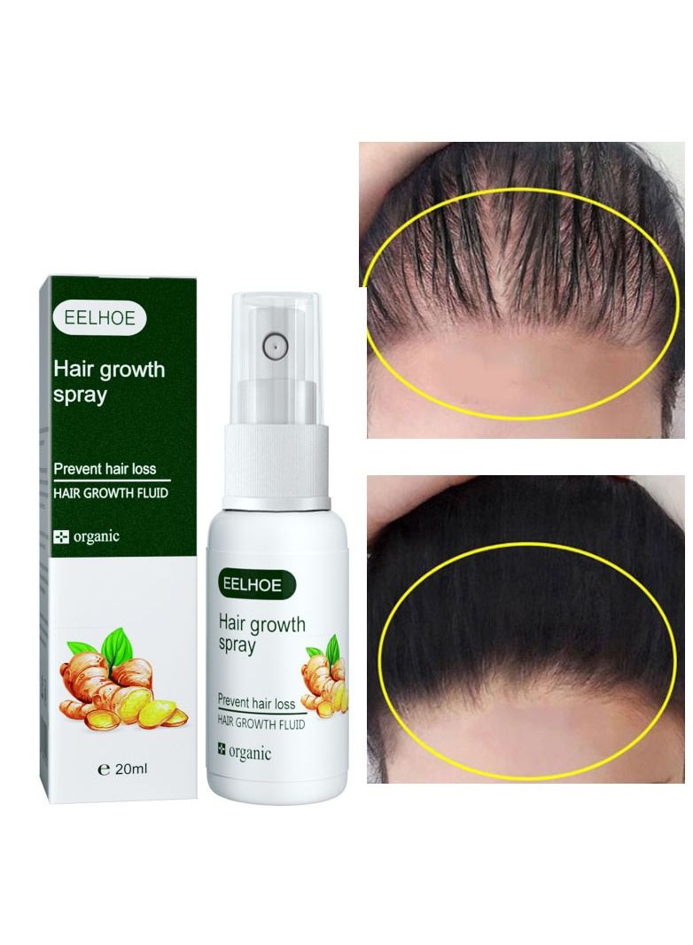 EELHOE Fast Hair Growth Spray Serum Ginger Anti Hair Loss Treatment Product Prevent Thinning Dry Frizzy Repair Beauty Hair Care Essence - Image 5