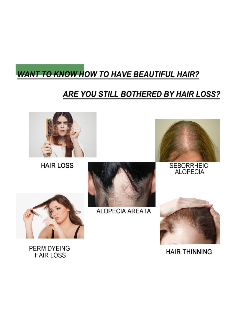 EELHOE Fast Hair Growth Spray Serum Ginger Anti Hair Loss Treatment Product Prevent Thinning Dry Frizzy Repair Beauty Hair Care Essence - Image 2