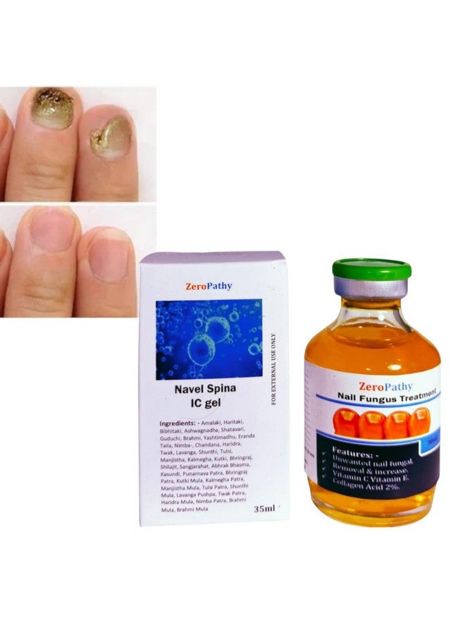 Zero Pathy ZeroPathy Nail Care Cream For Cuticle Care, Nail Growth & Strength Soft, Smooth, & Strong Lustrous Nails Unisex Nail Growth & Repair Ayurveda Cream - Herbal Nail Problem Solution Oil 35ml - Image 1