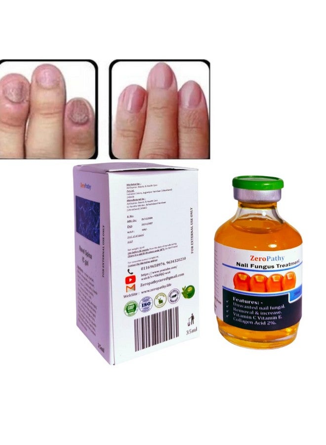 Zero Pathy ZeroPathy Nail Care Cream For Cuticle Care, Nail Growth & Strength Soft, Smooth, & Strong Lustrous Nails Unisex Nail Growth & Repair Ayurveda Cream - Herbal Nail Problem Solution Oil 35ml - Image 4