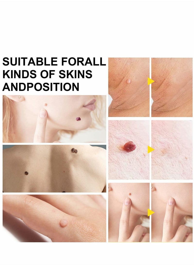 Y&D Skin-Tag-Remover, 2 in-1 Skin-Tag-Removal Device Kit for Small to Large Size (2mm-7mm) Skin-Tags, Painless Remover-Tags Most Body Parts  - Image 2