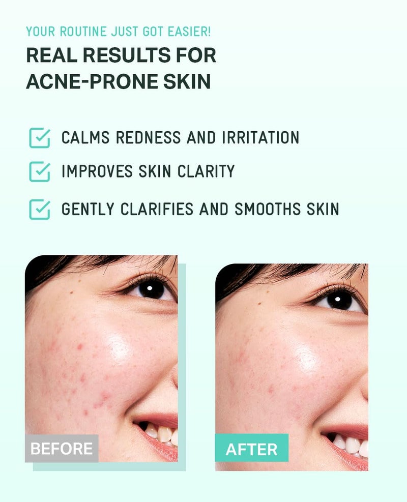 BRING GREEN Tea Tree CICA Soothing Toner | Mild Daily Skincare Routine for Cooling and Hydrating Effect (8.5 Fl. Oz., 250ml) - Image 5