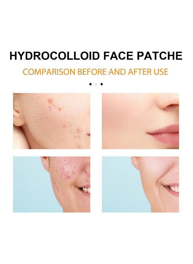 EELHOE Hydrocolloid Face Acne Pimple Patch 20PCS/Box (4pcs * Forhead Patch+4pcs * Nose Patch+4pcs * Cheeck* Chin Patch+8pcs * Cheek Patch) Portable