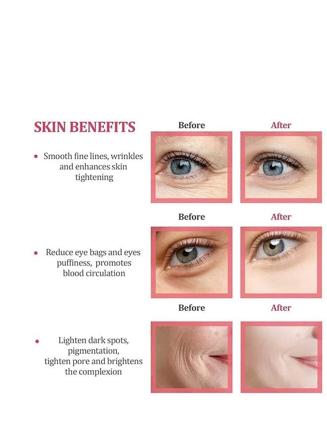 إسكدنيا فريدة من نوعها على شكل وردة الوجه الشباك ، جمال الوجه تدليك الوجه المكعب مضيئة ( أسود ) - Image 5