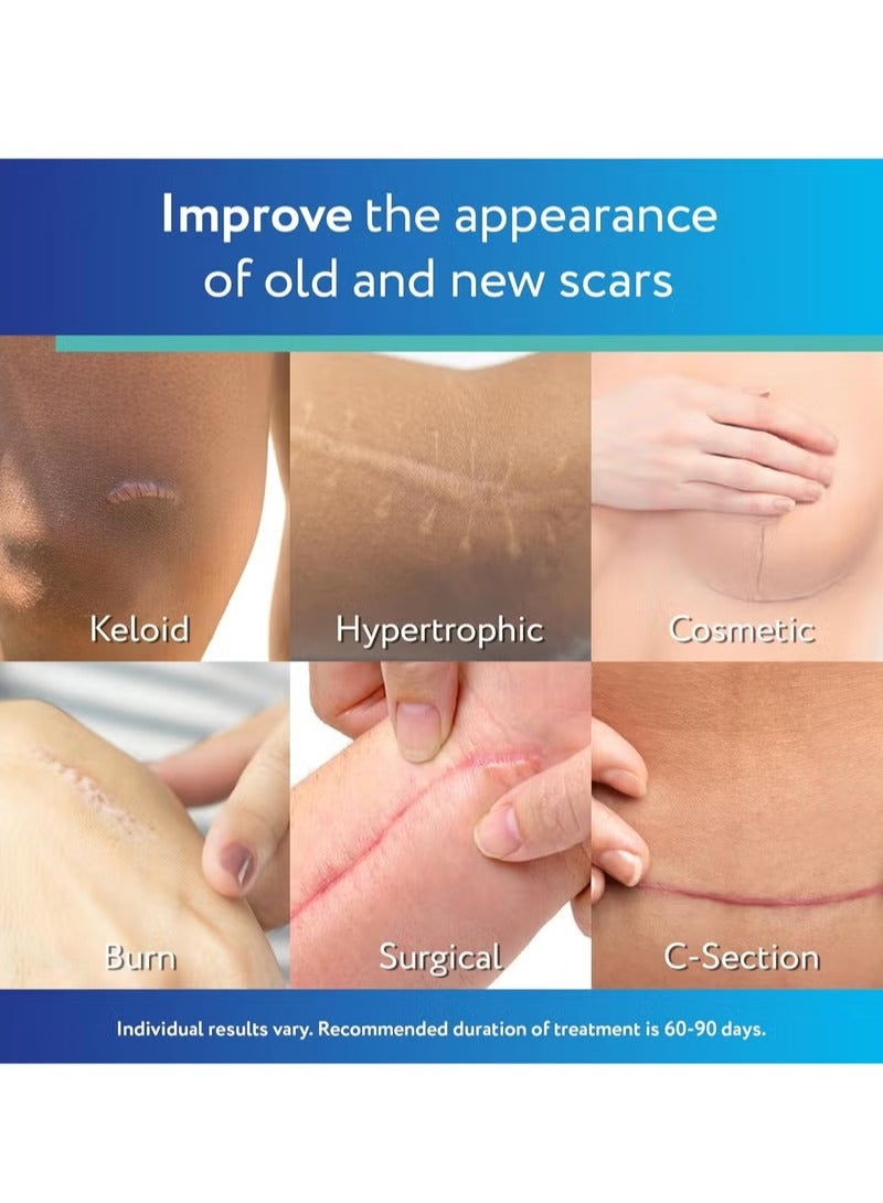 سكار أواي شرائح سيليكون شفافة لعلاج الندبات من سكار أواي، لون أبيض، 6 قطع - Image 3