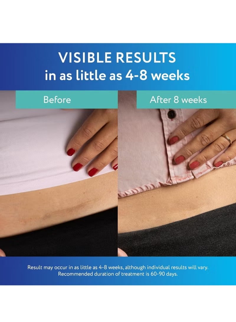 سكار أواي شرائح سيليكون شفافة لعلاج الندبات من سكار أواي، لون أبيض، 6 قطع - Image 5