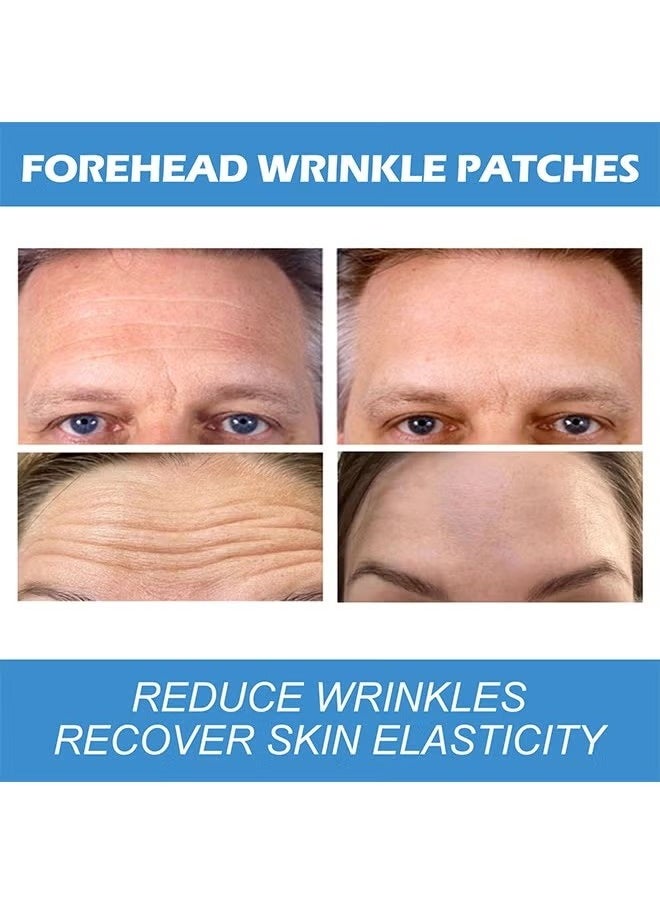 EELHOE - Forehead Wrinkle Patches 12pcs - Smooth Fine Lines & Wrinkles, Anti-Wrinkle Patches with Hydrolyzed Collagen with Aloe,Vitamin E, Anti Wrinkle Patches, Forehead Wrinkles Treatment - Image 1