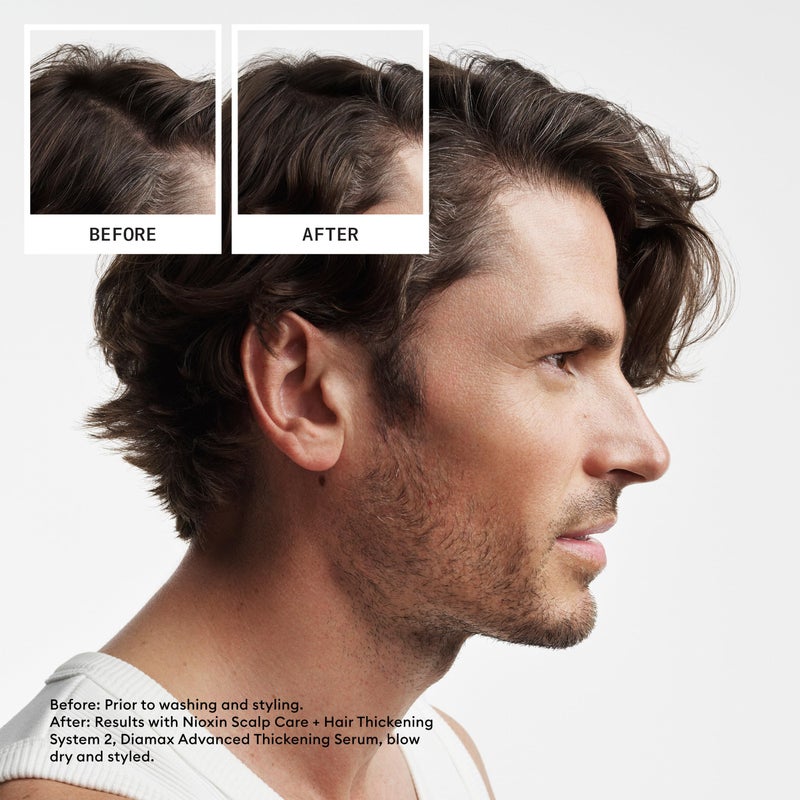 Nioxin Scalp + Hair Thickening System 2 Conditioner| For Natural or Untreated Hair with Progressed Thinning| With Niacinamide and Biotin | 33.8 Fl oz. - Image 2