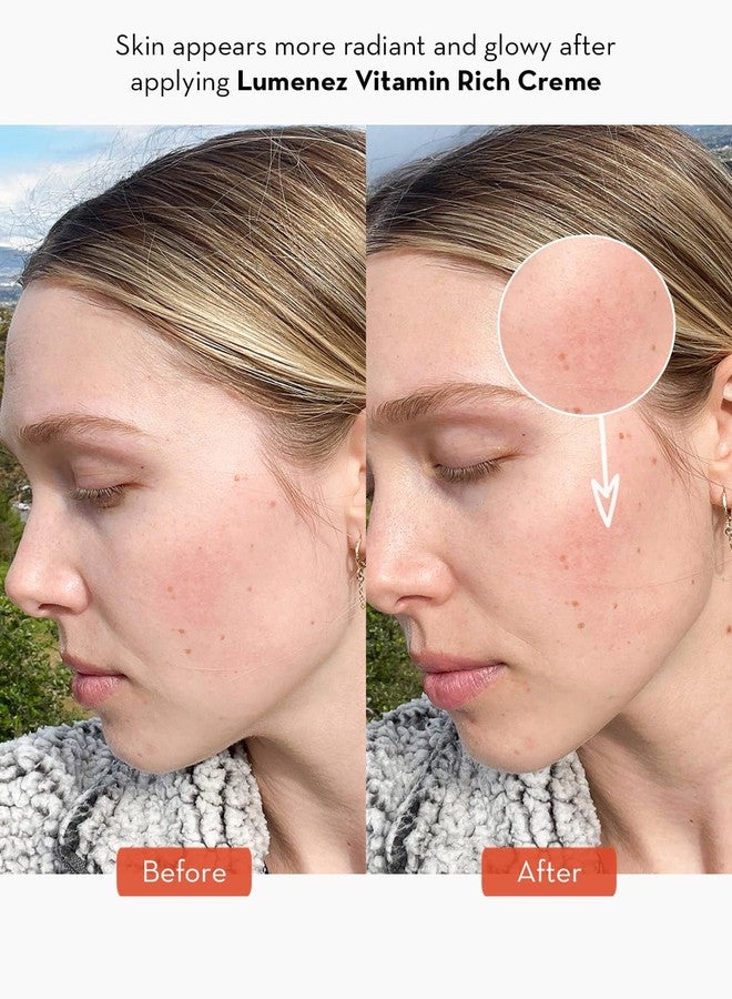 SONAGE Lumenez Vitamin Facial Cream: Daily Restorative Moisturizer with Vitamin C | Hydrating Cream for Dry Skin - Image 5