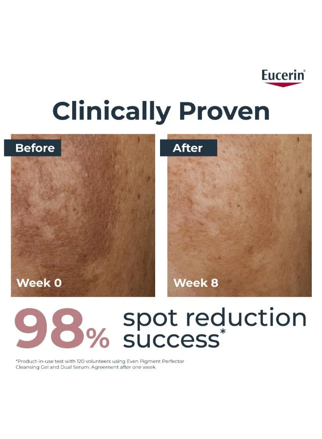 Eucerin  Eucerin Even Pigment Perfector Day 50ml  | Best Price UAE