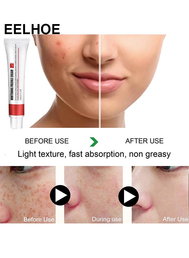 EELHOE Whitening Freckle Cream, Help Reduce Dark Spots, Anti-Aging, Beauty Skin Care, Spot Cream, Spot Treatment 20G - Image 5