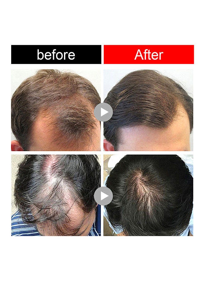 Jaysuing JAYSUING 1Pc Anti-hair Loss Ginger Shampoo Bar Balance Oil Increasing Hair Volume Nourish Hair Root Hair Growth  - Image 5
