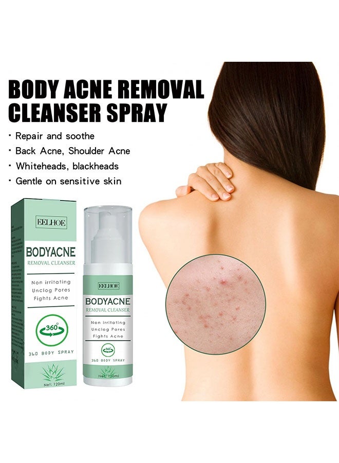 EELHOE Bodyacne Removal Cleanser, Back Acne Treatment, Back & Body Exfoliating Acne Spray, Smooth Skin, Back Moisturise, Acne Treatment for Bacne, Blackheads & Blemishes 120ml - Image 2
