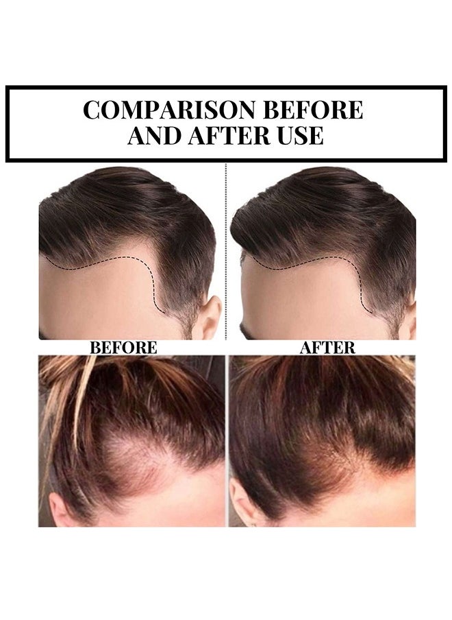 EELHOE - Plant Extract Hair Growth Oil, Ginger Essential Oil Hair Growth, for Hair Loss, Hair Grow Thicker And Longer, Fast Hair Growth 30ML - Image 1