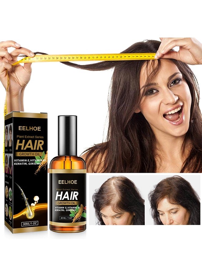 EELHOE - Plant Extract Hair Growth Oil, Ginger Essential Oil Hair Growth, for Hair Loss, Hair Grow Thicker And Longer, Fast Hair Growth 30ML - Image 1