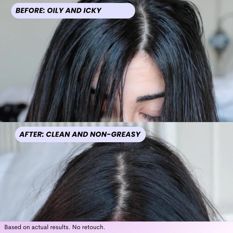 FoxyBae Turned Up Dry Shampoo Spray - Dry Shampoo for Women with Biotin for Hair Growth - Volumizing, Refreshing & Non-Toxic - 7 Fl Oz - Image 3