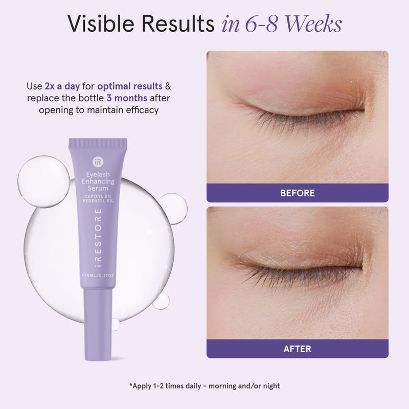 iRESTORE Eyelash Growth Serum | Vegan Prostaglandin Free & Non Irritating | For Thicker, Fuller, Longer and Gorgeous Eye Lashes | Lash Enhancing Serum | 3 Month Supply 5ml - Image 2