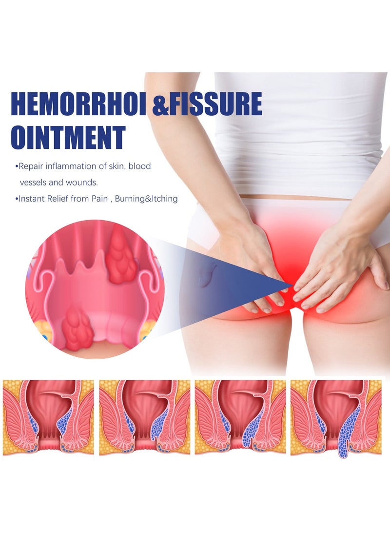 SOUTH MOON Doctor Hemorrhoid and Fissure Ointment Treatment with , Pure Aloe Vera, Amino Acids and Essential Oils and Minerals - Image 5