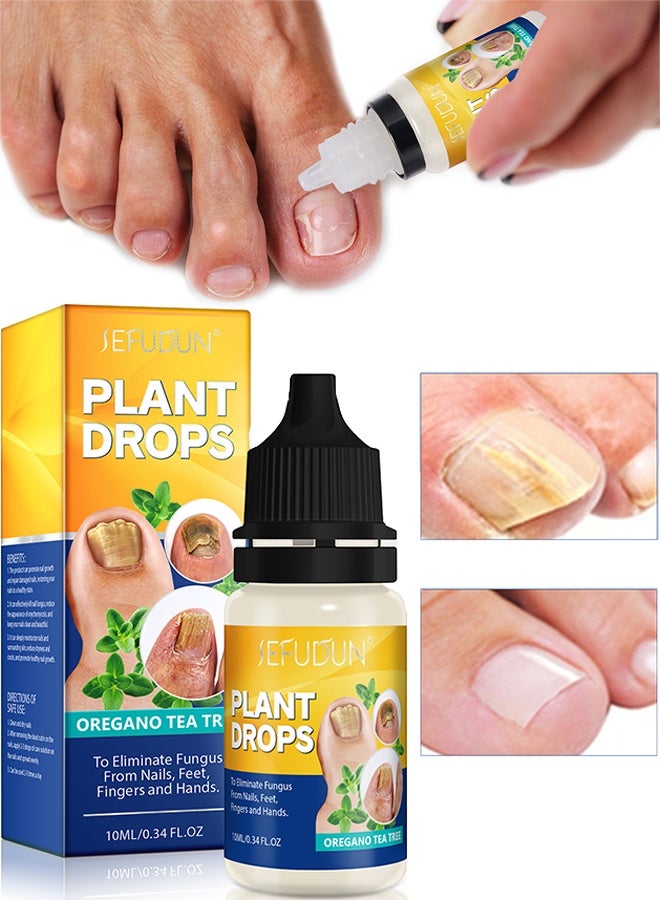 Sefudun Plant Drops， Nail Care Oregano Tea Tree Plant Drops for Nail Fungus Treatment Serum for Toenails and Fingernails Oregano Oil Fungal Nail Renewal Anti Fungus Nail Repair Gel 10ml - Image 1