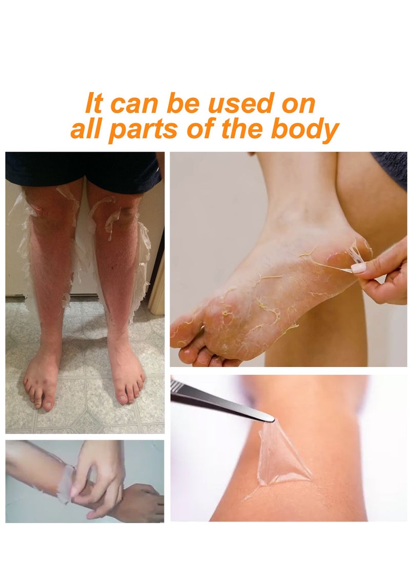 EELHOE - 100 ML Body Whitening Peeling Lotion for Dark Skin Body Exfoliation, Effectively Soften The Keratin, Improve Rough Epidermis Delay Skin Aging And Make The Skin Soft And Elastic,Whiten And Smooth - Image 1
