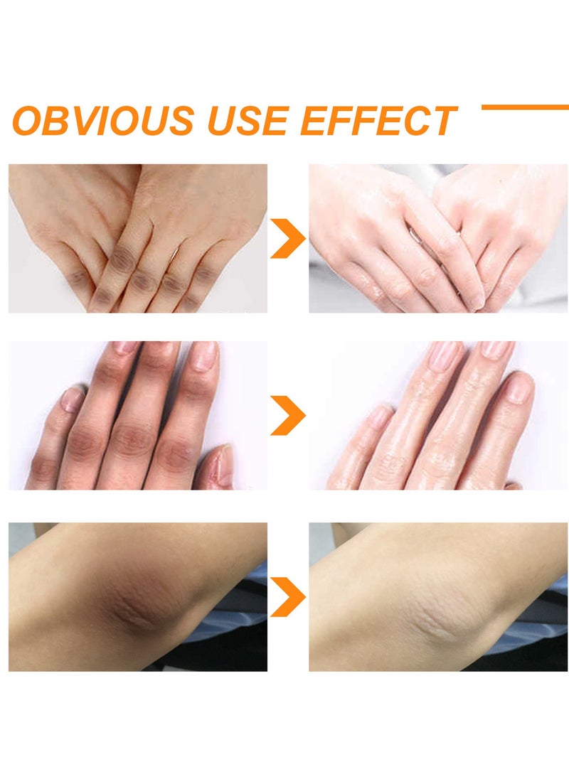 EELHOE - 100 ML Body Whitening Peeling Lotion for Dark Skin Body Exfoliation, Effectively Soften The Keratin, Improve Rough Epidermis Delay Skin Aging And Make The Skin Soft And Elastic,Whiten And Smooth - Image 1