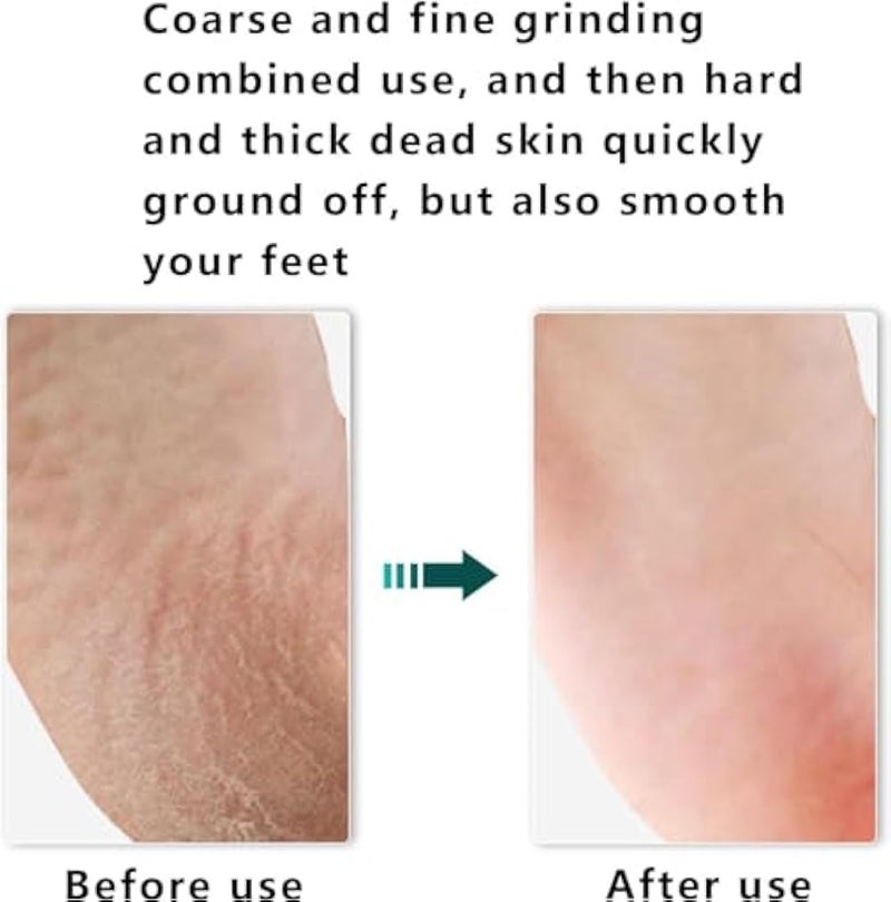 Wood Foot File Double Sided Callus Remover Pedicure Foot Rasp for Wet and Dry Foot Care Dead Skin Removing (Random Color) - Image 4