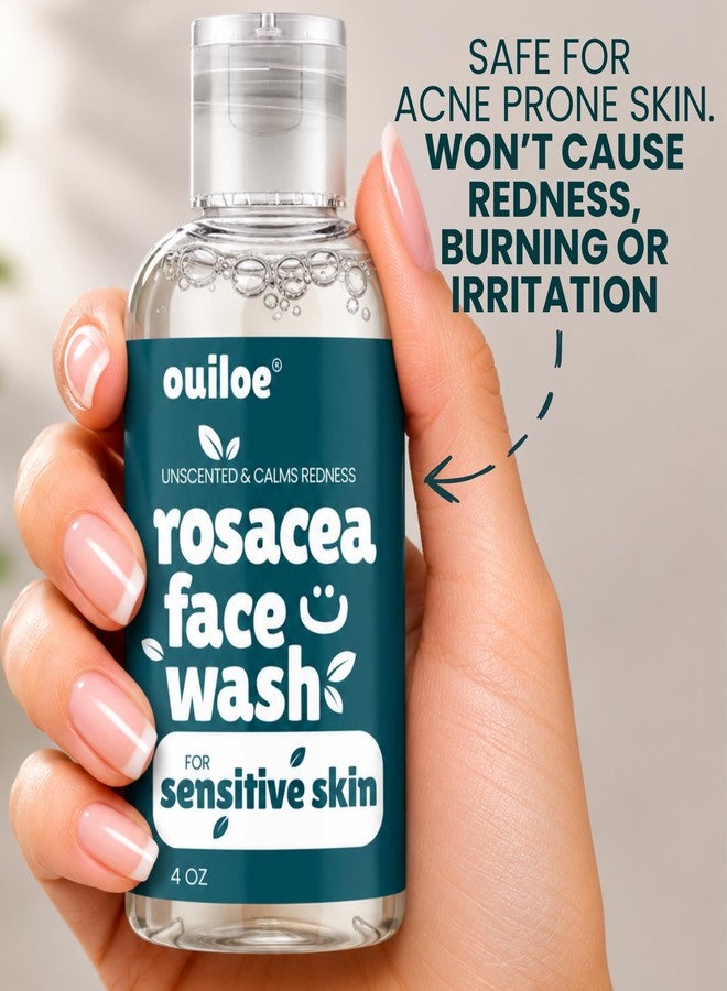 Ouiloe Rosacea Face Wash for Sensitive Skin - Non Comedogenic Face Wash - Safe for Acne Prone Skin - Unscented, Sulfate Free, pH Balanced, Paraben Free, 4oz - Image 4