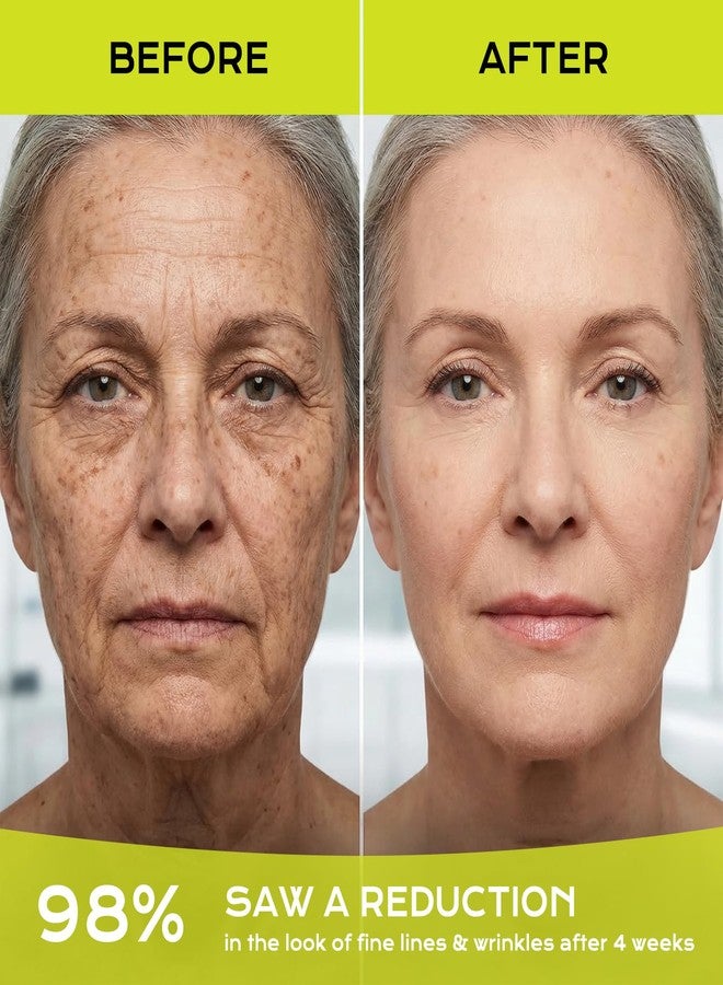 Aikertec 2 Pack Vita-A Retinol Wrinkle-Lift Tightening Cream,Retinal Shot- Anti-aging firming cream, smooths skin, minimizes pores & fine lines for all skin types&Korean Skin Care Gift - Image 5