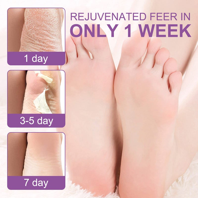 Mcukv Foot Peel Masks for Dry Cracked Feet 5 Pack,Exfoliating Foot Mask, Natural Exfoliator for Dead Skin, Callus, Repair Rough Heels for Men Women,Make your Foot Baby Soft in 7 Days, AlIVER - Image 3
