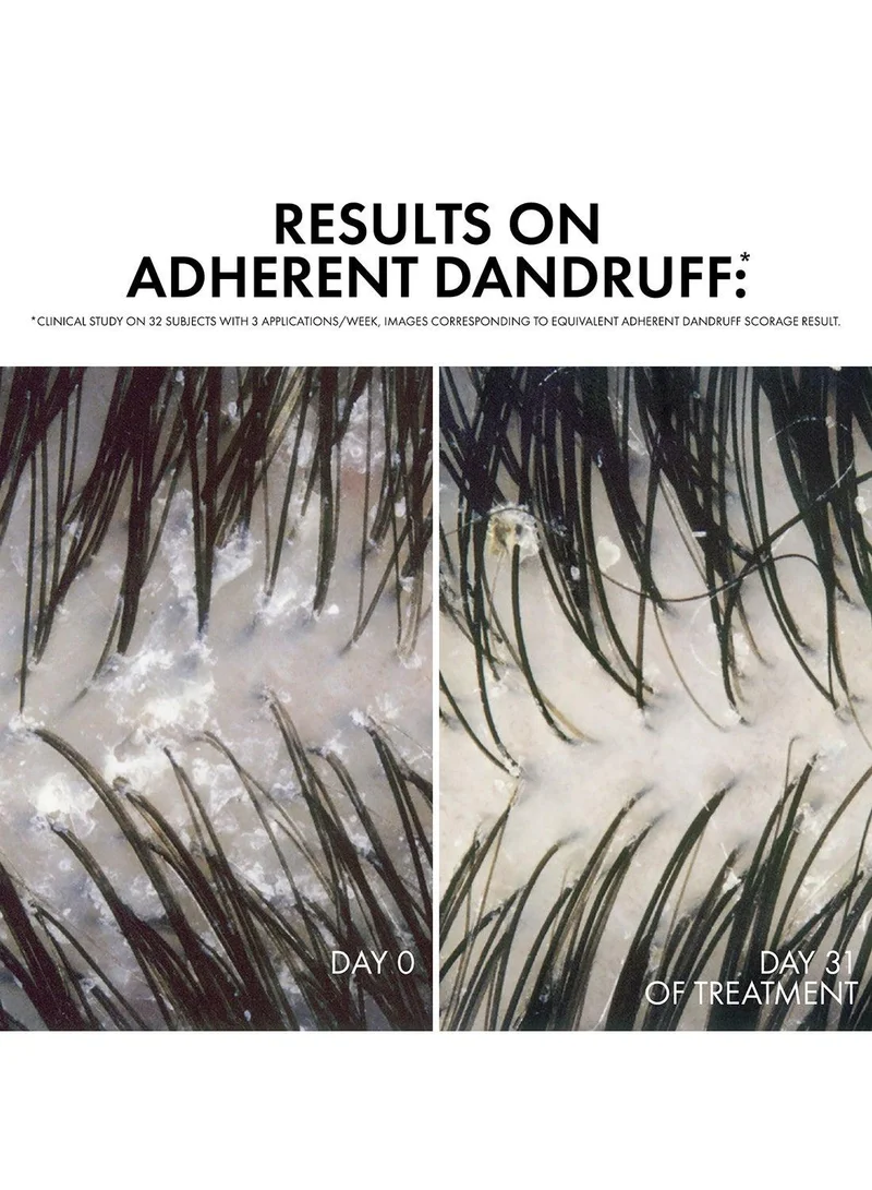 VICHY Dercos Anti-Dandruff Shampoo Normal to Oily Hair Refill 390ml