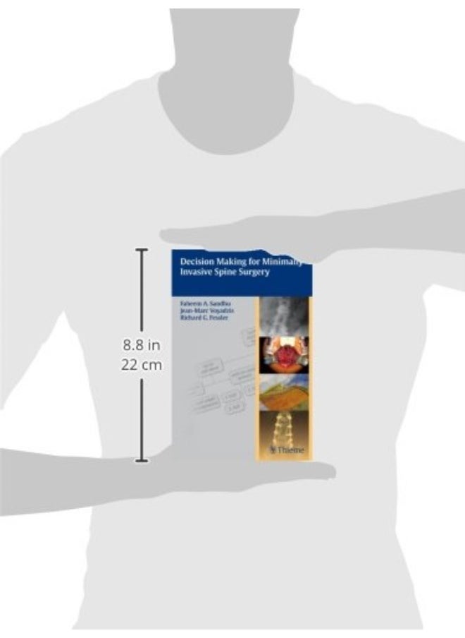 null - Decision Making for Minimally Invasive Spine Surgery - Image 1