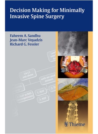 Decision Making for Minimally Invasive Spine Surgery - pzsku/ZCF18632A4E26A1FCC176Z/45/_/1724834627/b17fbf45-b851-4fe9-ba4f-f3f5e2584cb8