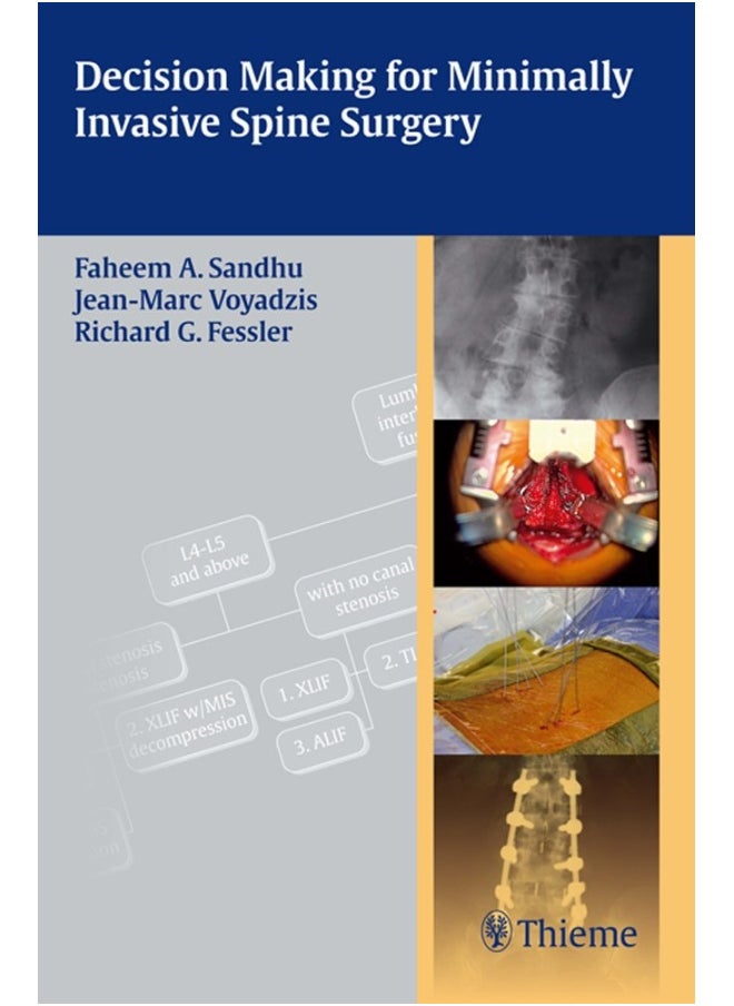 null - Decision Making for Minimally Invasive Spine Surgery - Image 1