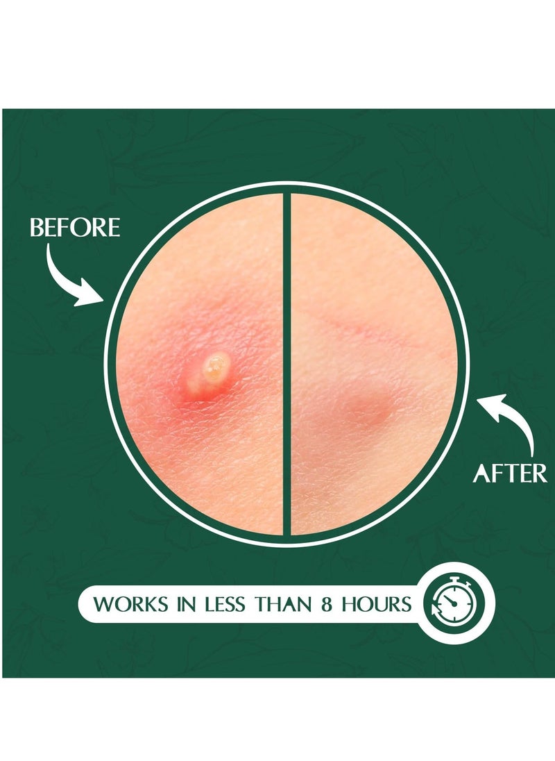 Aroura Aroura Premium Pimple Acne Patches Invisible (120 Pack) - For Day and Night - Hydrocolloid Acne Dots for Clear Skin - Advanced Zit Patches and Acne Stickers  - Image 5