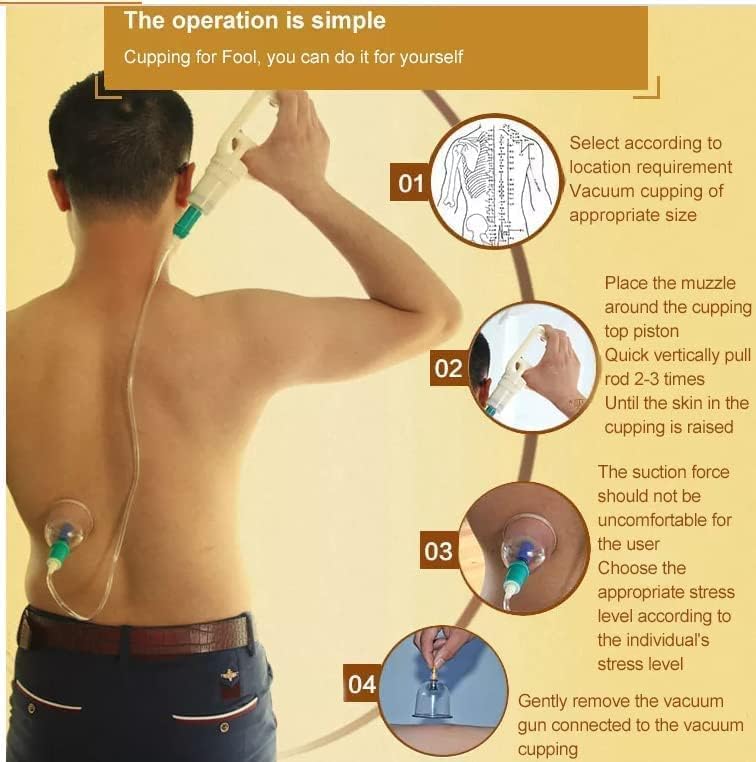 PERDANT طقم علاج الحجامة 24 قطعة أكواب تدليك الإبر الصينية المحمولة للاسترخاء - Image 4