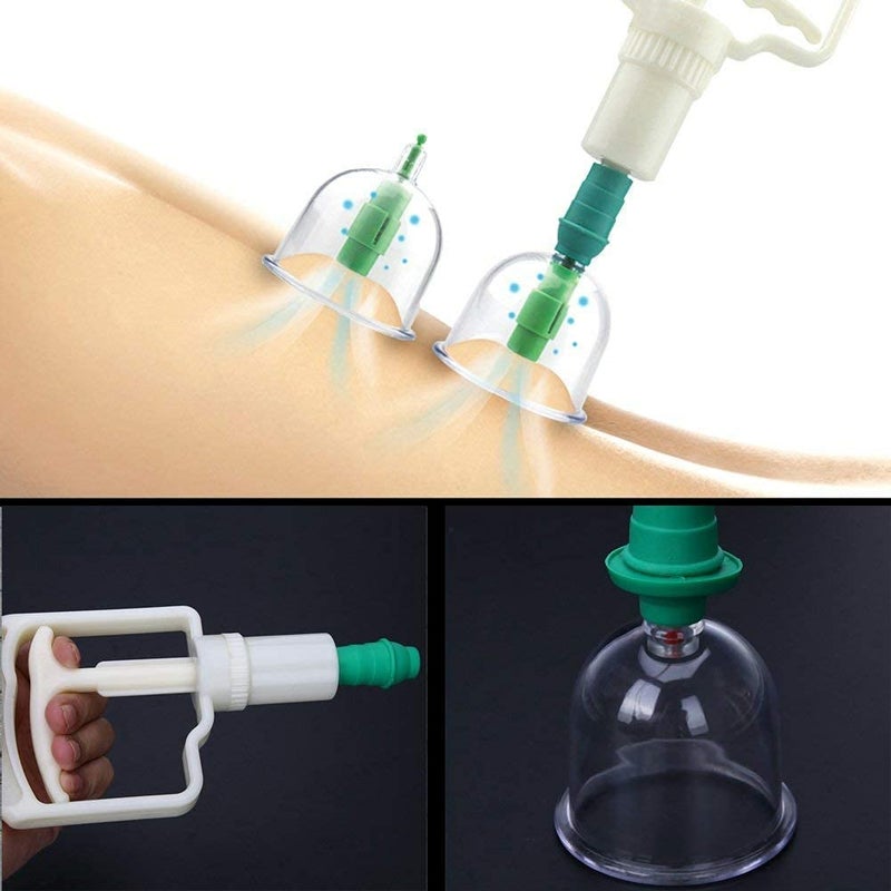 PERDANT طقم علاج الحجامة 24 قطعة أكواب تدليك الإبر الصينية المحمولة للاسترخاء - Image 3