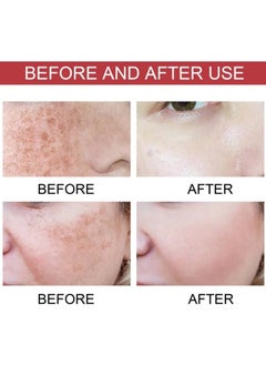 Anua korean Premium Korean Skincare! Anua Serum with 10% Niacinamide + 4% Tranexamic Acid, Infused with Ceramide, Hyaluronic Acid and Vitamin B12, Natural Hue, Fragrance-Free Formula, Ideal for Sensitive Skin, Achieve Glass Skin, 30 ml  - Image 2