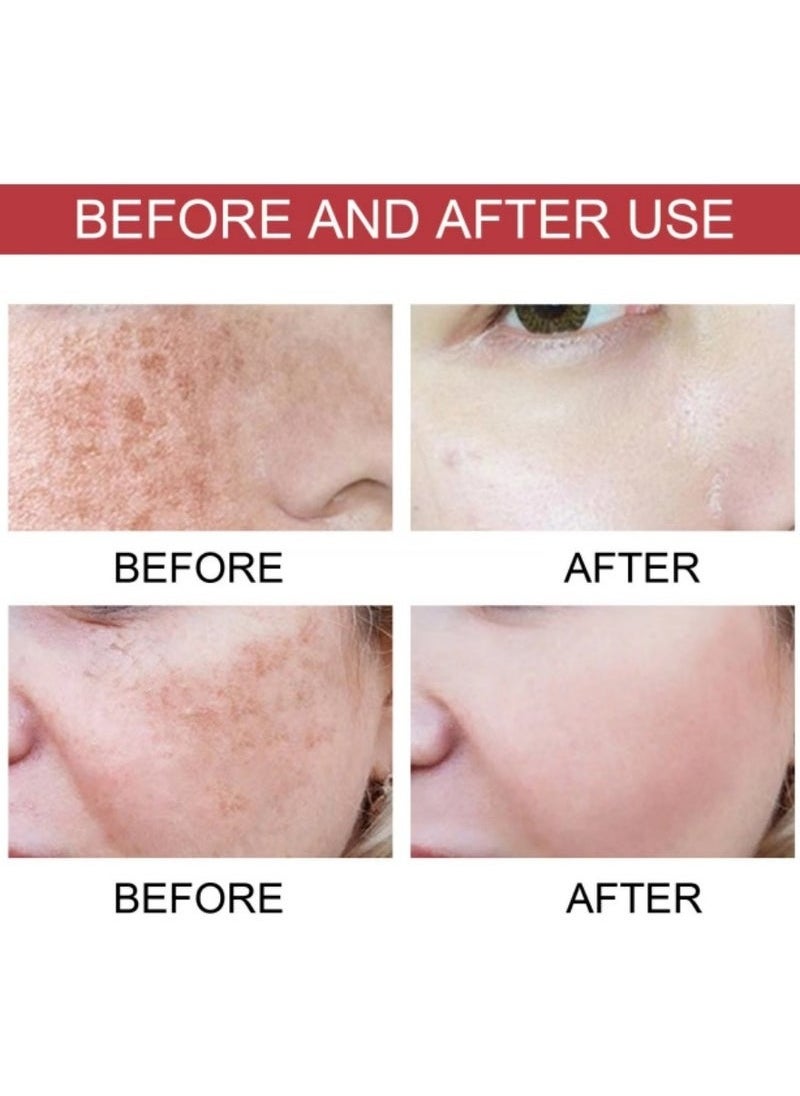Anua korean Premium Korean Skincare! Anua Serum with 10% Niacinamide + 4% Tranexamic Acid, Infused with Ceramide, Hyaluronic Acid and Vitamin B12, Natural Hue, Fragrance-Free Formula, Ideal for Sensitive Skin, Achieve Glass Skin, 30 ml  - Image 2