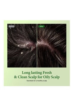 KUNDAL Kundal Tea Tree & Macadamia Deep Cleansing Shampoo [Jasmine Woody] - Korean Hair Care, Scalp Care, Tea Tree extract, For All hair Types 10.14fl oz (pack of 1)  - Image 4