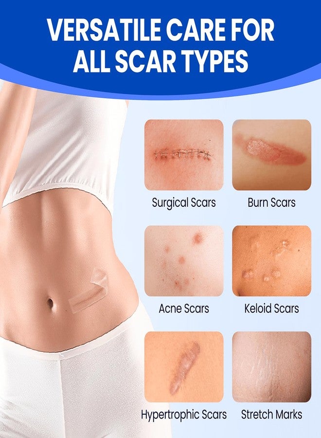 Bioemmalab Silicone Scar Sheets Medical Grade Tape (1.6"x150" Roll Healing Patches for C-Section, Keloid, Face Wrinkles, Stretch Marks, Surgical Recovery, Professional Scar Cover for Sensitive Skin, Soft Tissue - Image 3