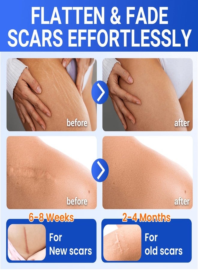 Bioemmalab Silicone Scar Sheets Medical Grade Tape (1.6"x150" Roll Healing Patches for C-Section, Keloid, Face Wrinkles, Stretch Marks, Surgical Recovery, Professional Scar Cover for Sensitive Skin, Soft Tissue - Image 2