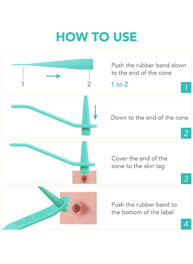 Sefudun - 2 In 1 Skin Tag Removal Tool Kit Painless Easy-Using Device For Small To Large Sized Skin Tag On Face Neck And Body， Double Head Wart Removal Tool Skin Tag Removal Green - Image 1