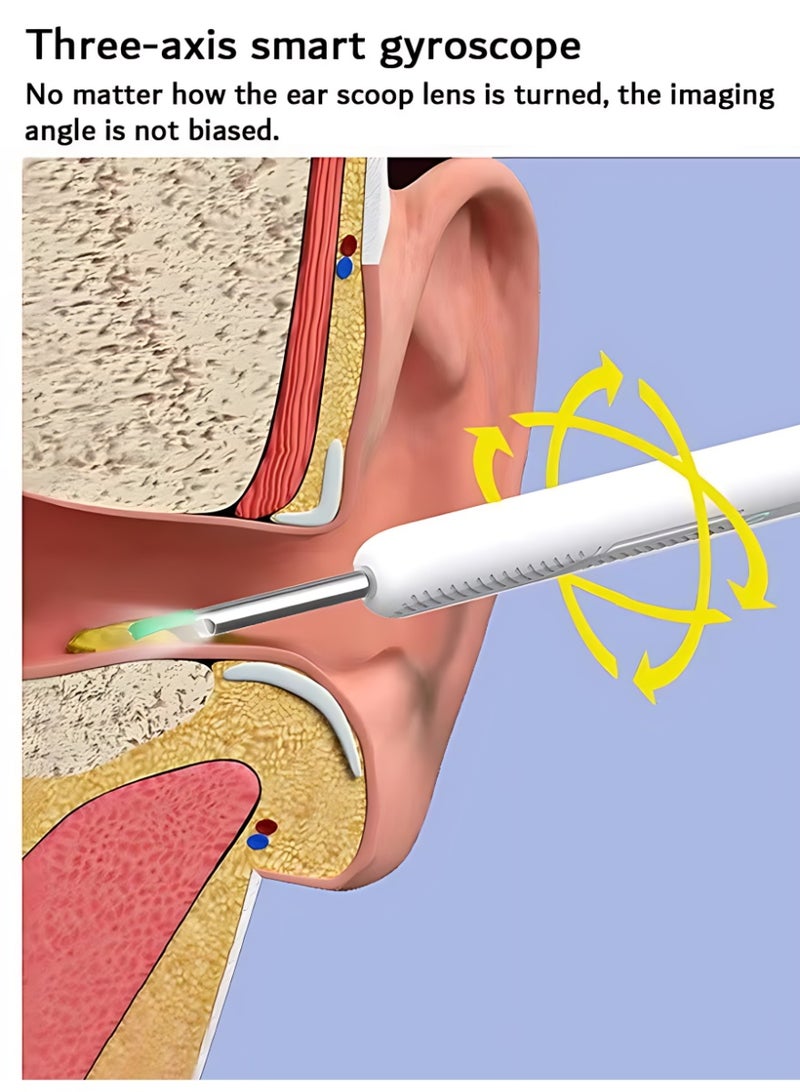 الآلة الصغيرة مجموعة تنظيف شمع الأذن، مزودة بكاميرا عالية الدقة 1080 وواي فاي، تحتوي على 12 أداة تنظيف و6 ملاعق للأذن مع حقيبة تخزين (أبيض) - Image 3