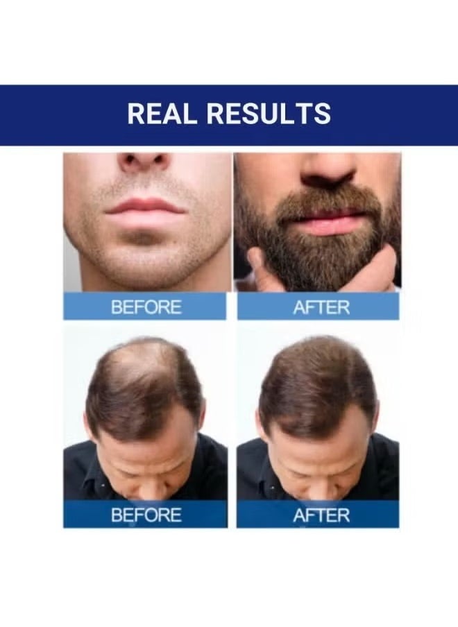 Kirkland Signature - 6-Piece Minoxidil Hair Regrowth Treatment - Image 1