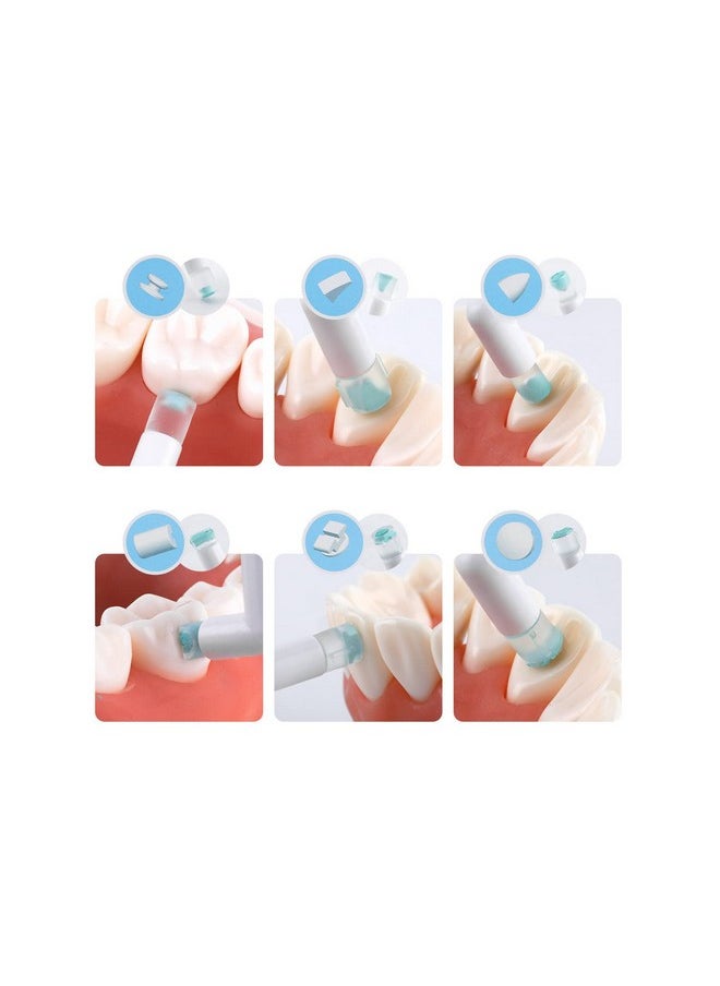 Protector Orthodontic Mould Mold Mini Orthodontic Accessories Injection Mould Starter Kit Tubes Lingual Retainer Button Set  - Image 5
