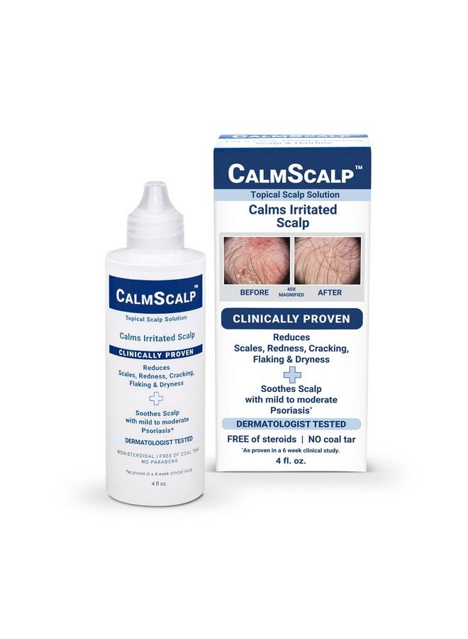محلول موضعي من CalmScalp لعلاج أعراض الصدفية الخفيفة إلى المتوسطة | فروة الرأس المتهيجة | قشور خط الشعر | احمرار | فروة الرأس الجافة | صنع في الولايات المتحدة الأمريكية | 4 أونصة. - Image 1