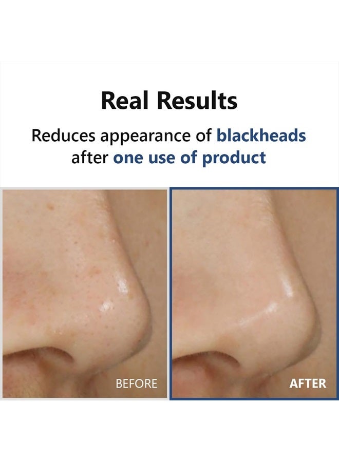 IsNtree سيروم ISNTREE Hyper Acid AHA BHA PHA LAH 30 | مقشر كيميائي لطيف | سيروم قابل للغسل | العناية بالبشرة على الطريقة الكورية - Image 4