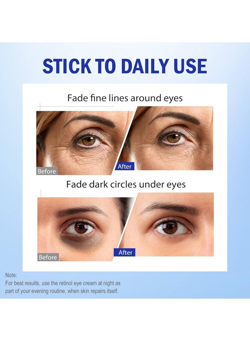 هويجي كريم العين الرتينول, ترطيب تحت كريم العين كريم التجاعيد اليومي, ضخ لتناعم وترطيب الجلد, كريم العين لعلاجات الدوائر الداكنة, تخفيض تحت أكياس العين, التجاعيد الناعم, 1Pack - Image 3